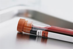 blood_test